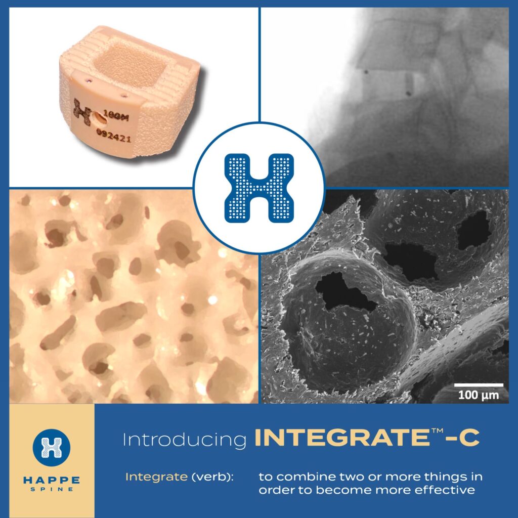 Introducing Integrate-C by HAPPE Spine