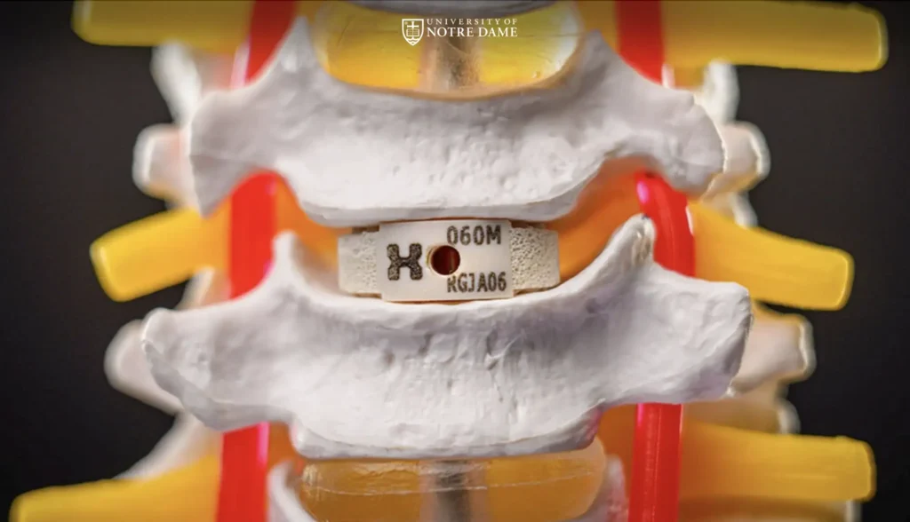 HAPPE Spine Notre Dame feature