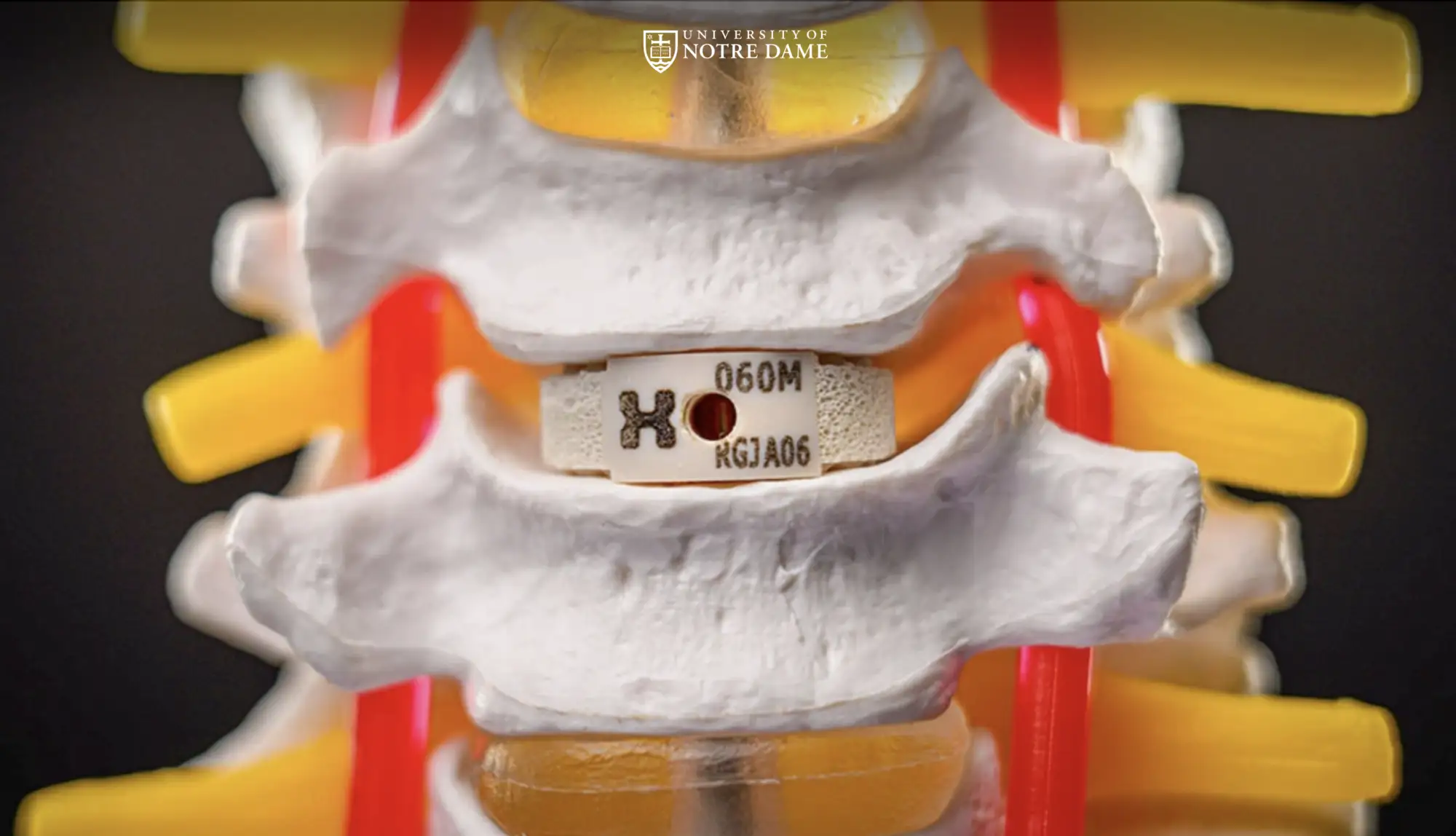 HAPPE Spine Notre Dame feature