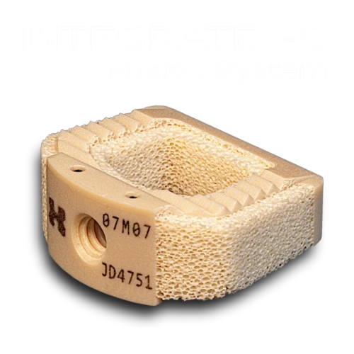 INTEGRATE-C Fusion System implant